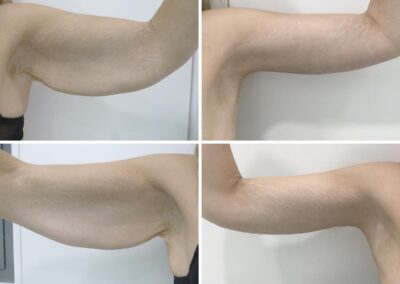 Blanquiopl-.11200x900