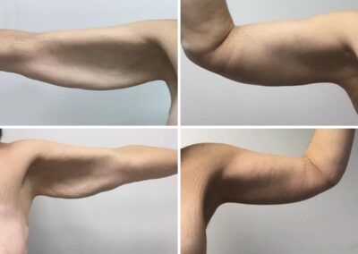 Blanquiopl.2-1200x900