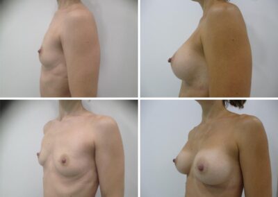 Caso clínico nº 1.2