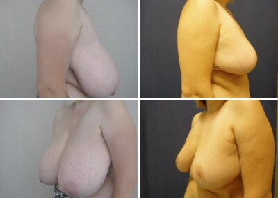 Caso clínico nº 1.2