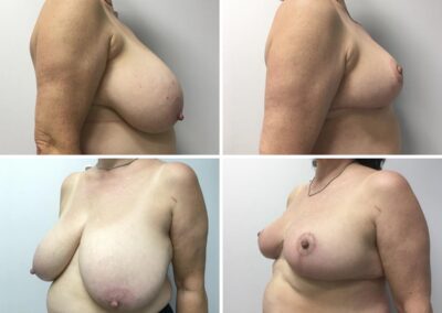 Caso clínico nº 2.2