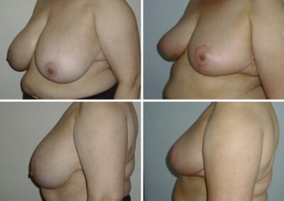 Caso clínico nº 3.2